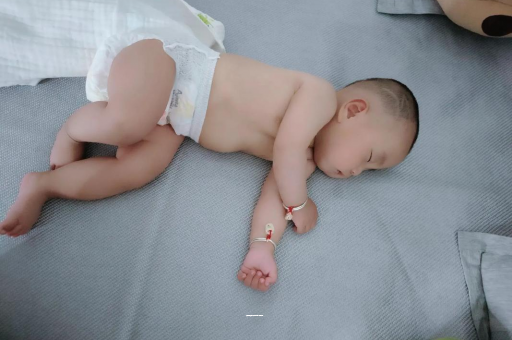 大理宝宝上火有眼屎